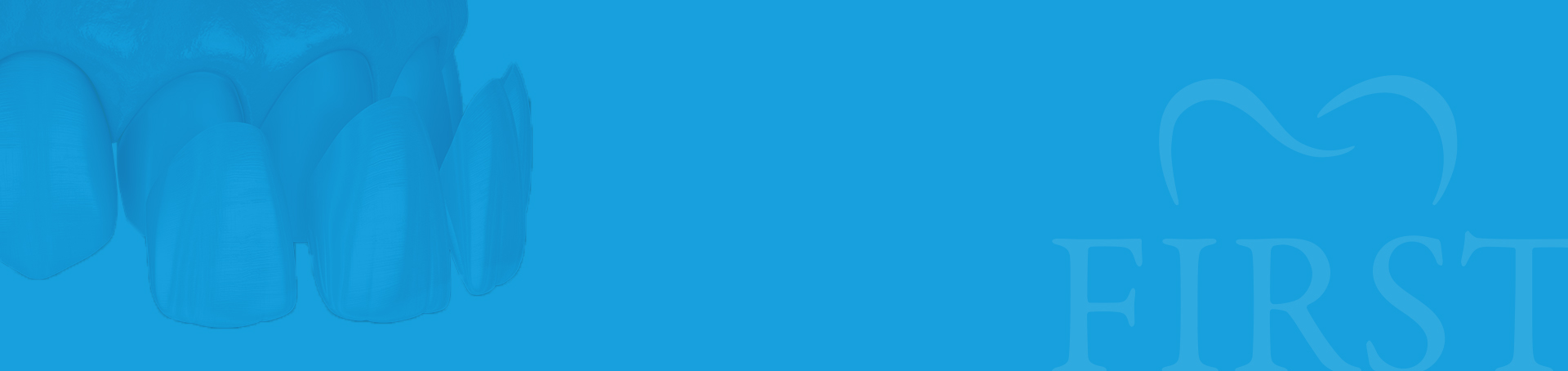 원데이 라미네이트