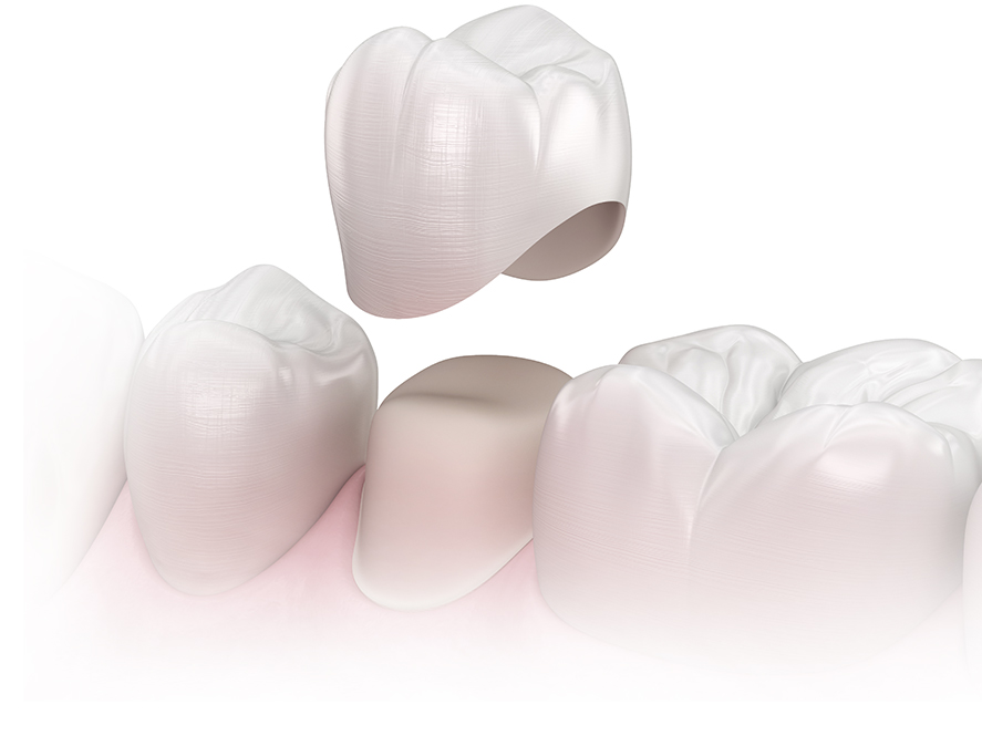 datalCare03_con01_01