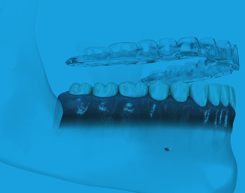 세라핀 교정 이미지